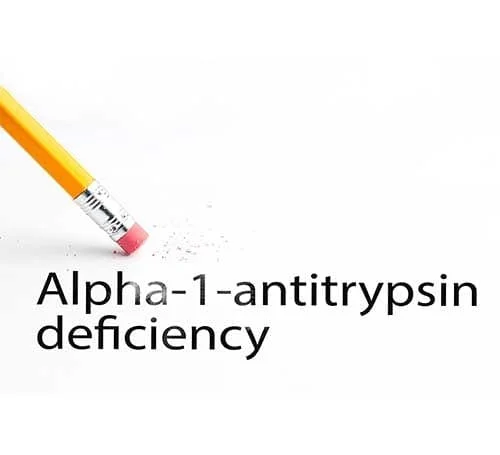Alpha1ConditionInfusionVentures | Infusion Ventures alt tagAlpha 1 Condition Infusion Ventures
