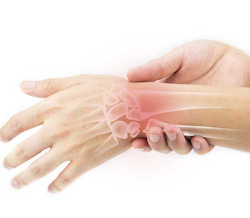 alt tagrheumatoid arthritis Infusion Ventures