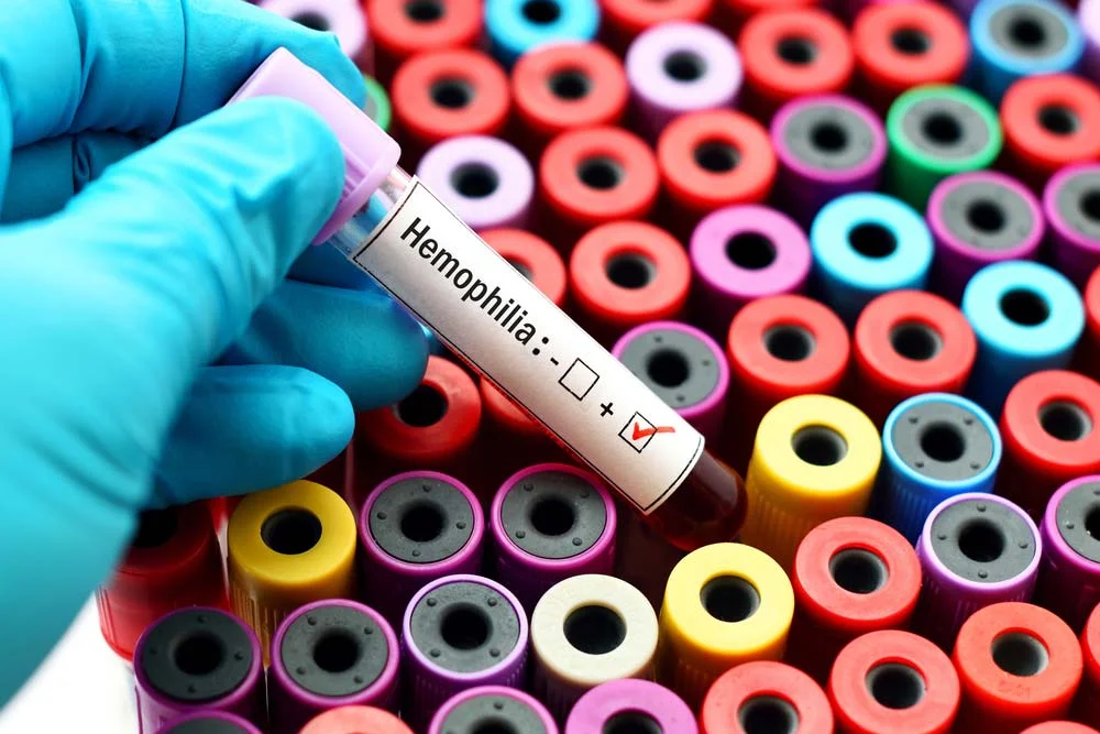 Infusion Ventures nurses are experts in infusion therapy for patients with Von Willebrand and other bleeding disorders.