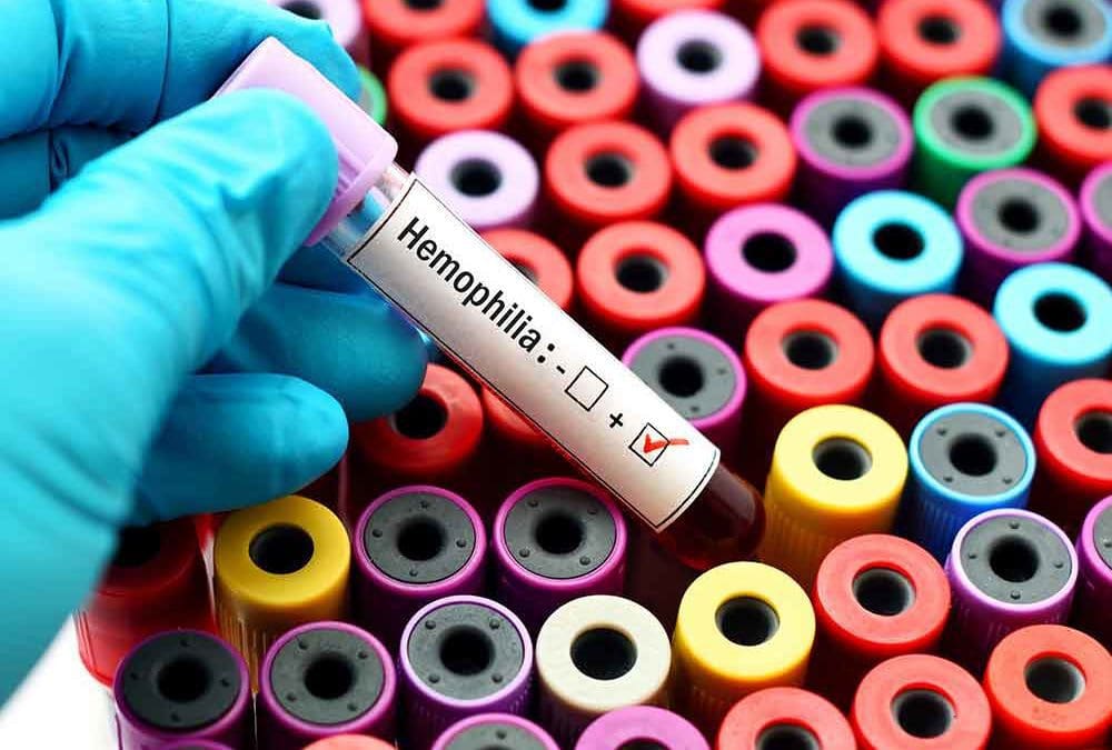 ‘Reverse Vaccination’ May Help Prevent Immune Response | Hemophilia News Today