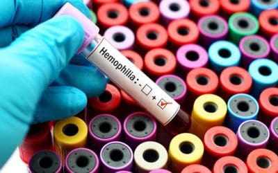 ‘Reverse Vaccination’ May Help Prevent Immune Response | Hemophilia News Today
